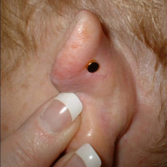 Stress Relief New Green Earring Magnet Acupressure - Picture 2 of 4